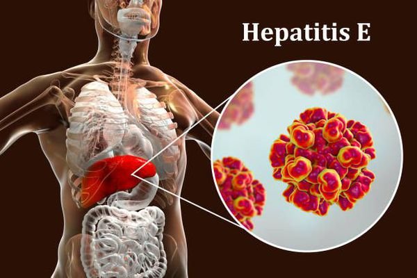 Ученые нашли новый способ лечения гепатита Е