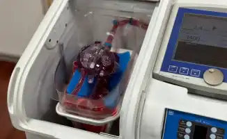 Сердца в ожидании: 137 казахстанцев на грани жизни