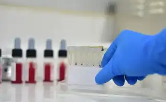 В Кызылординской области зафиксированы случаи конго-крымской геморрагической лихорадки