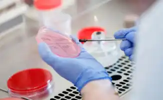 Сибирская язва в Казахстане: угроза для здоровья и новые случаи заражения в Шымкенте и регионах страны