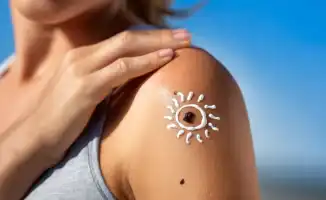 Летнее солнце и здоровье кожи: когда казахстанцам стоит проверять родинки у врача?