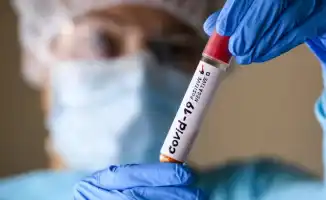 В России зарегистрированы четыре случая заражения новым коронавирусом