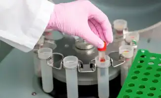 Сибирская язва: тень болезни накрывает Акмолинскую область