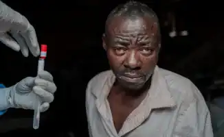 ВОЗ одобрила первую вакцину против оспы обезьян для расширения борьбы с заболеванием