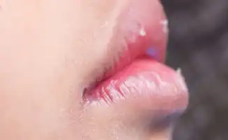 Весна пришла: сонливость, усталость и частые простуды атакуют