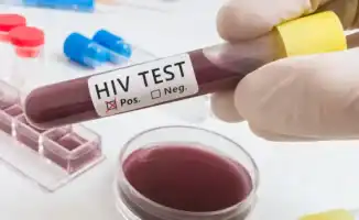 ВИЧ в прошлом: немецкий пациент подтвердил полное выздоровление спустя пять лет после лечения