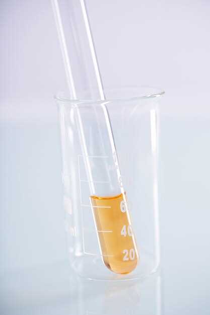 Билирубин в моче причины и диагностика