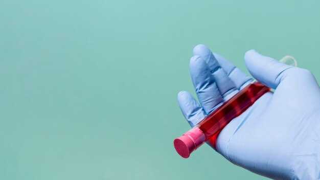 Анализ уровня Crea в крови и его значение для здоровья