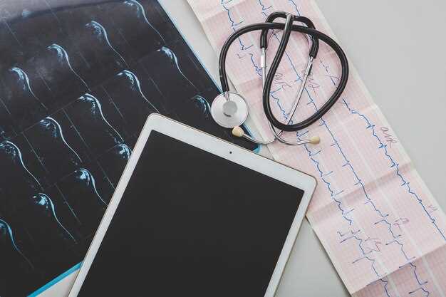 Информация об ЭКГ сердца и ее значении для здоровья