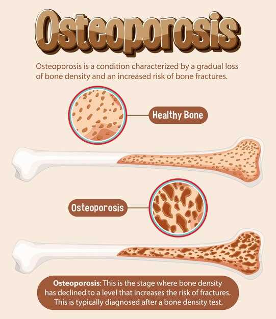 Гематогенный остеомиелит