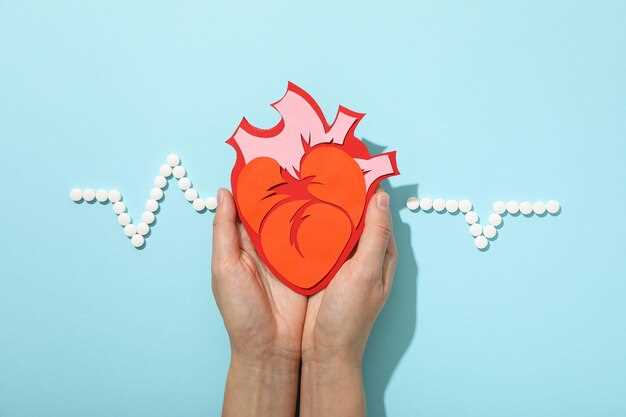 Инфаркт миокарда