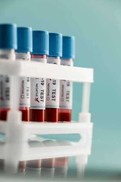 Клинический анализ крови инвитро особенности и преимущества