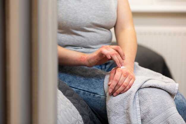 Корь у взрослых