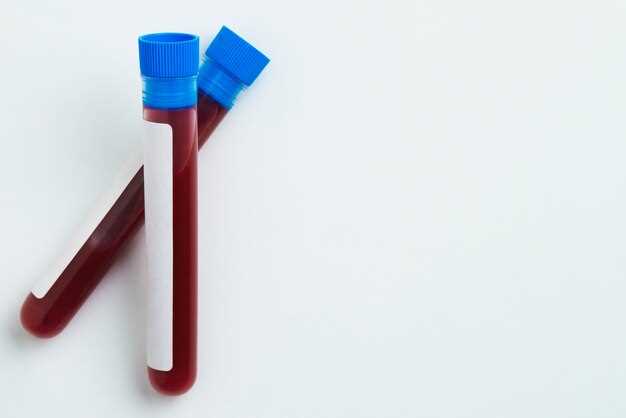 Как правильно сдать кровь на коагулограмму