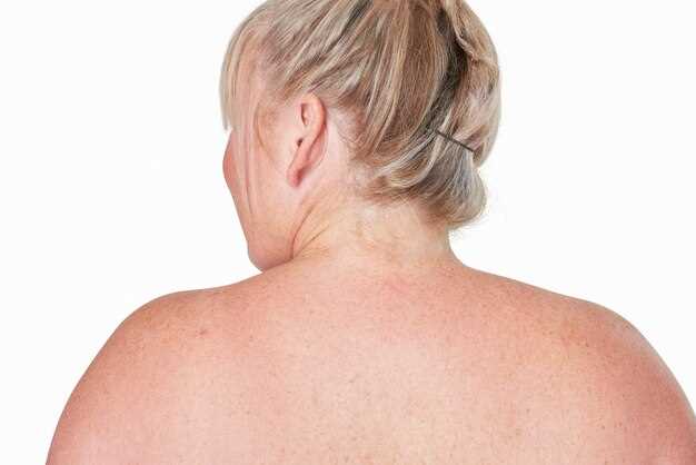 Лимфогранулематоз