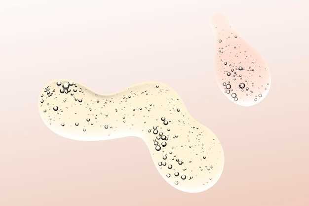 Мазок на микрофлору: что необходимо знать