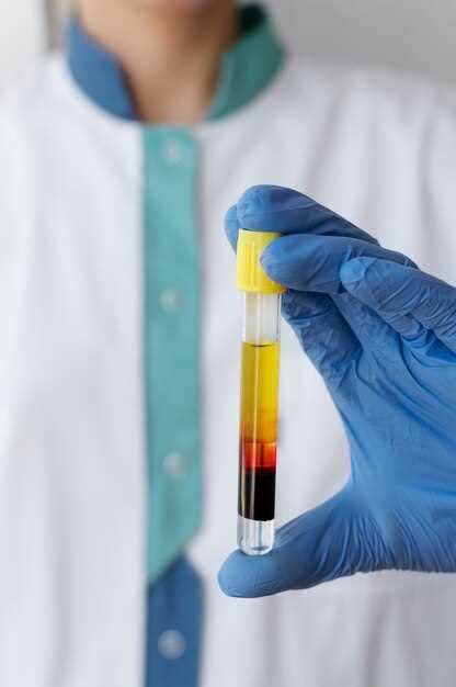 Мочевая кислота в крови причины и последствия