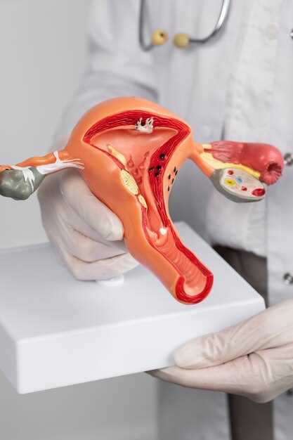 Наружный эндометриоз