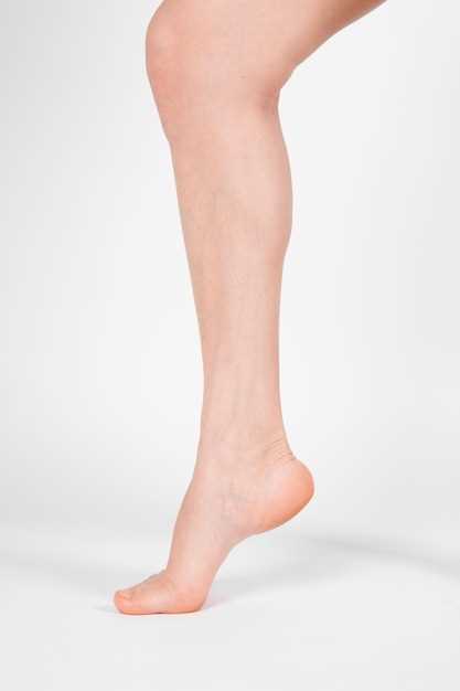 О-образные ноги