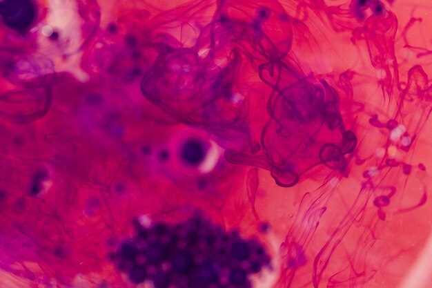 Опухоли подкожной, соединительной и других мягких тканей