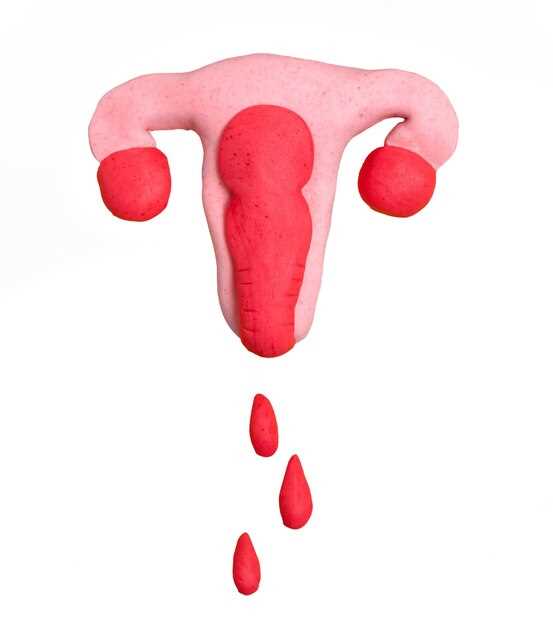 Опухоли яичников