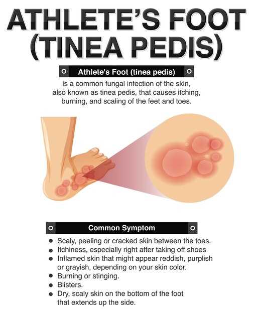 Подошвенные бородавки