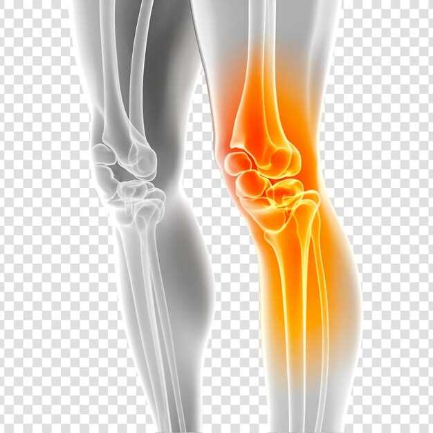 Повреждения связок коленного сустава