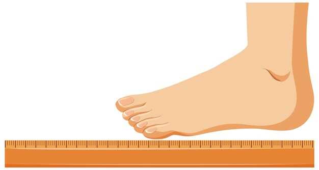 Продольное плоскостопие