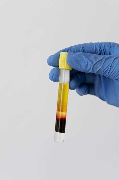 Правила сбора мочи на общий анализ для точных результатов