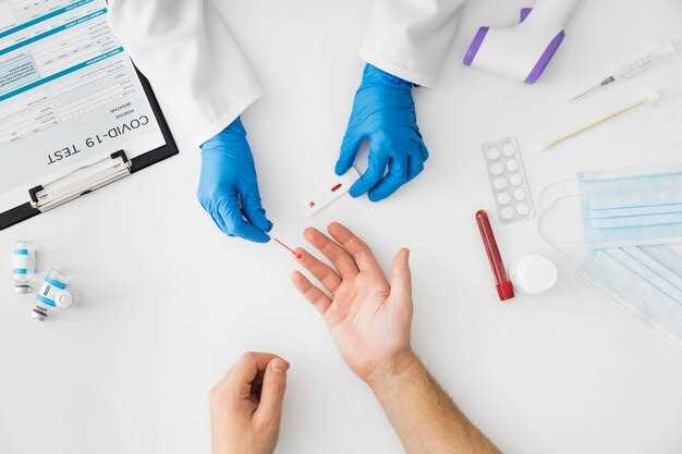 Как сдать общий анализ крови правильно и без ошибок