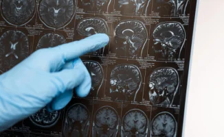 Хроническая бессонница увеличивает риск деменции на 40%!