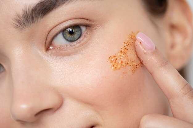 Венерическая гранулема