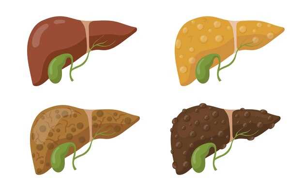 Жировой гепатоз