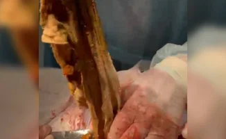 Алматинка 9 месяцев с салфеткой в животе: жалоба отклонена