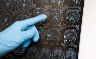 Исследование: Нехватка свободного времени может повышать риск деменции в мире