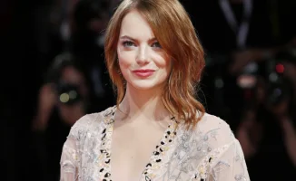 Исследование: названа женщина с 'идеальным лицом' по версии хирургов