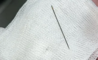 В Туркестане 8-месячный ребёнок с подозрением на краснуху: тревога для родителей и общества