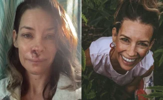 Эванджелин Лилли раскрыла последствия травмы мозга, угрожающие её карьере и здоровью