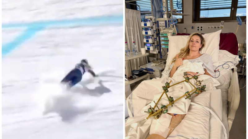 Линдси Вонн: три операции и борьба за возвращение на лед