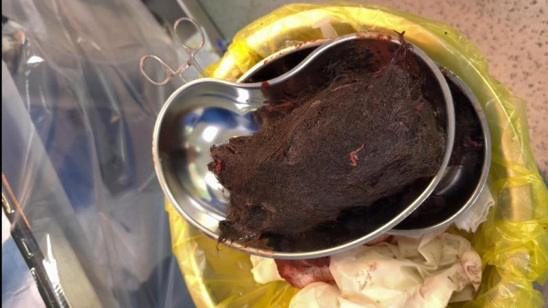 Случай с девочкой из Туркестанской области поднимает вопросы о здоровье и психологии подростков