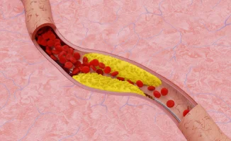 Холестерин: невидимый враг, скрывающийся в привычных вещах