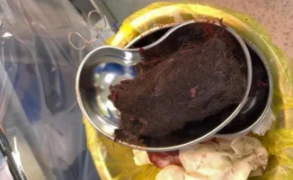 Случай с девочкой из Туркестанской области поднимает вопросы о здоровье и психологии подростков