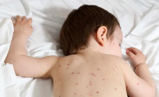 В Костанае детей с кишечной инфекцией изолировали в взрослую больницу из-за вспышки кори