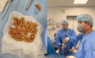 В Туркестане врачи удалили 80 камней из мочевого пузыря 61-летнего пациента